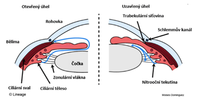 Anatomie glaukomu s otevřeným a uzavřeným úhlem